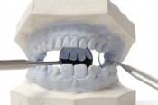 8 ways to save money at the dentist's office